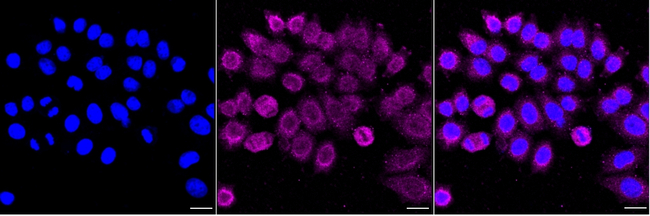 TMEM67 Antibody in Immunocytochemistry (ICC/IF)