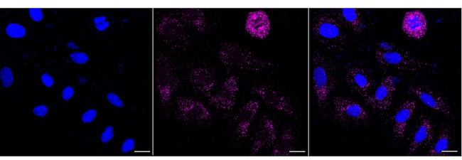 PMP70 Antibody in Immunocytochemistry (ICC/IF)
