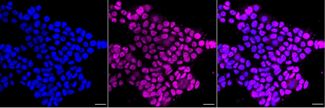 ESRRA Antibody in Immunocytochemistry (ICC/IF)
