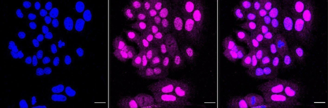 FRS2 Antibody in Immunocytochemistry (ICC/IF)