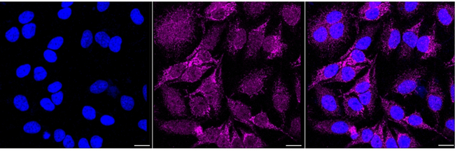 GALT Antibody in Immunocytochemistry (ICC/IF)