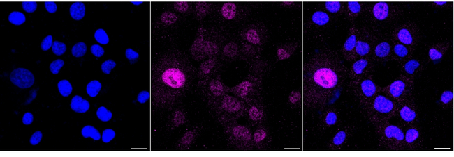DRD3 Antibody in Immunocytochemistry (ICC/IF)