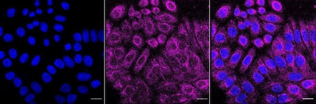 GCK Antibody in Immunocytochemistry (ICC/IF)