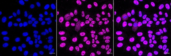 PAR2 Antibody in Immunocytochemistry (ICC/IF)