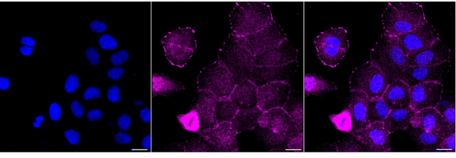 FHL2 Antibody in Immunocytochemistry (ICC/IF)