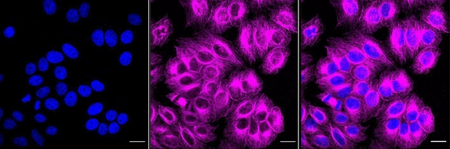 CHRM2 Antibody in Immunocytochemistry (ICC/IF)