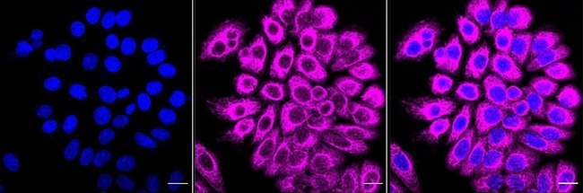 CYP2C9 Antibody in Immunocytochemistry (ICC/IF)