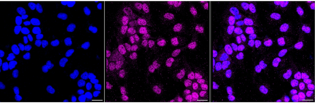 ERCC8 Antibody in Immunocytochemistry (ICC/IF)