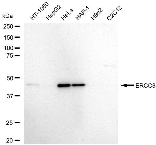 ERCC8 Antibody in Western Blot (WB)