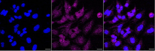 eIF3e Antibody in Immunocytochemistry (ICC/IF)