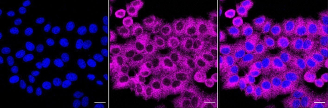 CaMKII Pan Antibody in Immunocytochemistry (ICC/IF)