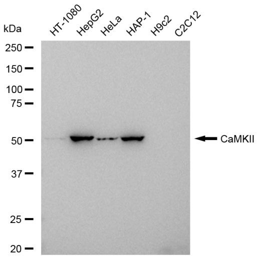 CaMKII Pan Antibody in Western Blot (WB)