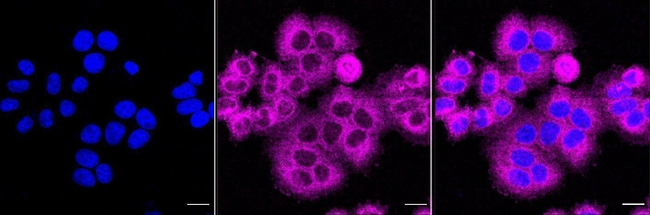 KLC1 Antibody in Immunocytochemistry (ICC/IF)