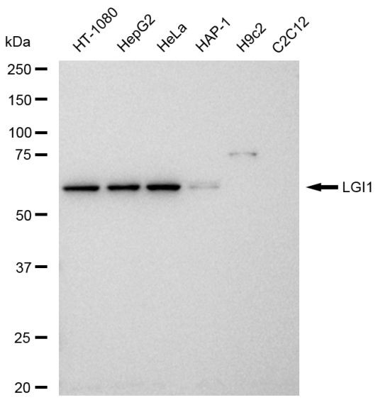 LGI1 Antibody in Western Blot (WB)