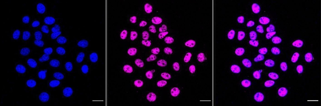HTATSF1 Antibody in Immunocytochemistry (ICC/IF)