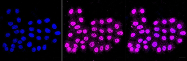 HOOK2 Antibody in Immunocytochemistry (ICC/IF)
