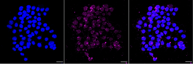 ITPA Antibody in Immunocytochemistry (ICC/IF)