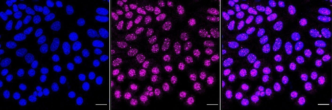 ITPK1 Antibody in Immunocytochemistry (ICC/IF)