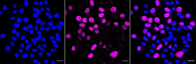 KIFC1 Antibody in Immunocytochemistry (ICC/IF)