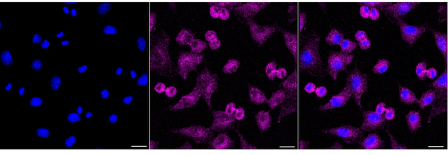 HIP1 Antibody in Immunocytochemistry (ICC/IF)