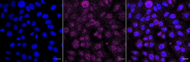 LDHA Antibody in Immunocytochemistry (ICC/IF)