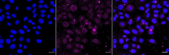 HOXB9 Antibody in Immunocytochemistry (ICC/IF)