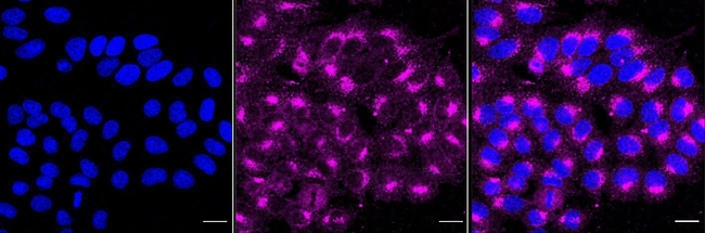 IGF2R Antibody in Immunocytochemistry (ICC/IF)