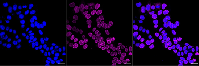 Lamin B Receptor Antibody in Immunocytochemistry (ICC/IF)