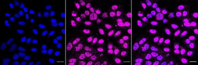 HTRA2 Antibody in Immunocytochemistry (ICC/IF)
