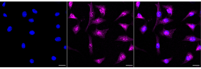 Cytokeratin 1 Antibody in Immunocytochemistry (ICC/IF)