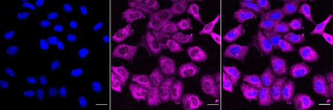 IL1RA Antibody in Immunocytochemistry (ICC/IF)