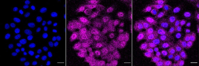 HDAC10 Antibody in Immunocytochemistry (ICC/IF)