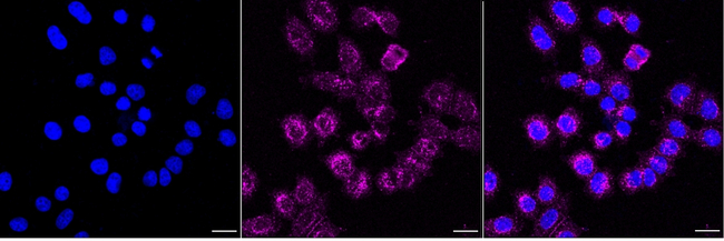 gamma Catenin Antibody in Immunocytochemistry (ICC/IF)