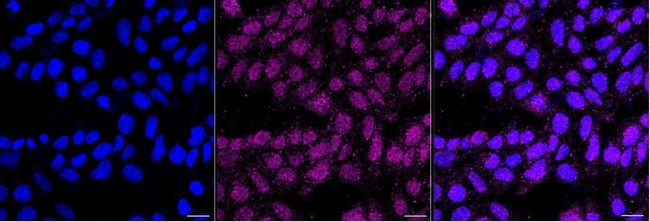 HLA-G Antibody in Immunocytochemistry (ICC/IF)