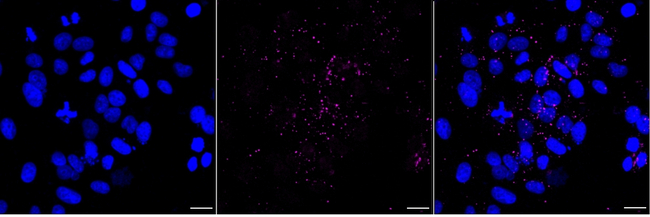 IFN beta Antibody in Immunocytochemistry (ICC/IF)