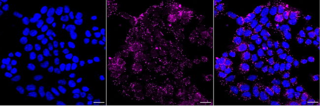 MHC Class I Antibody in Immunocytochemistry (ICC/IF)