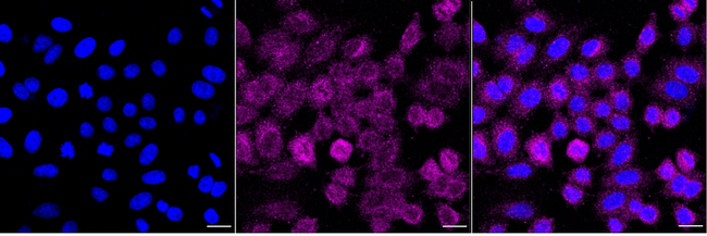 ITCH Antibody in Immunocytochemistry (ICC/IF)
