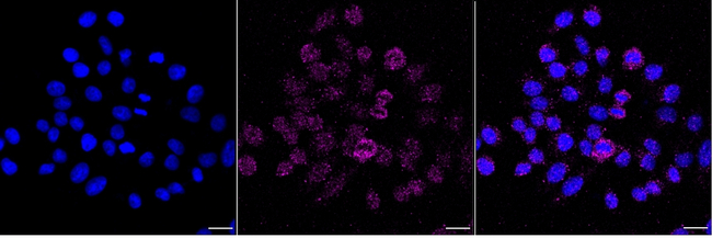 MDA5 Antibody in Immunocytochemistry (ICC/IF)