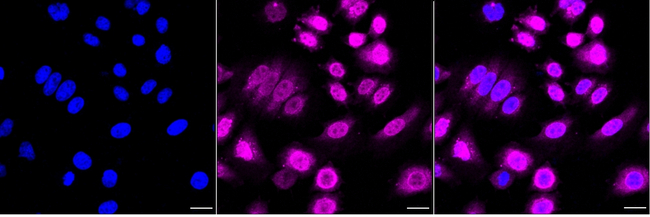 KPNA2 Antibody in Immunocytochemistry (ICC/IF)