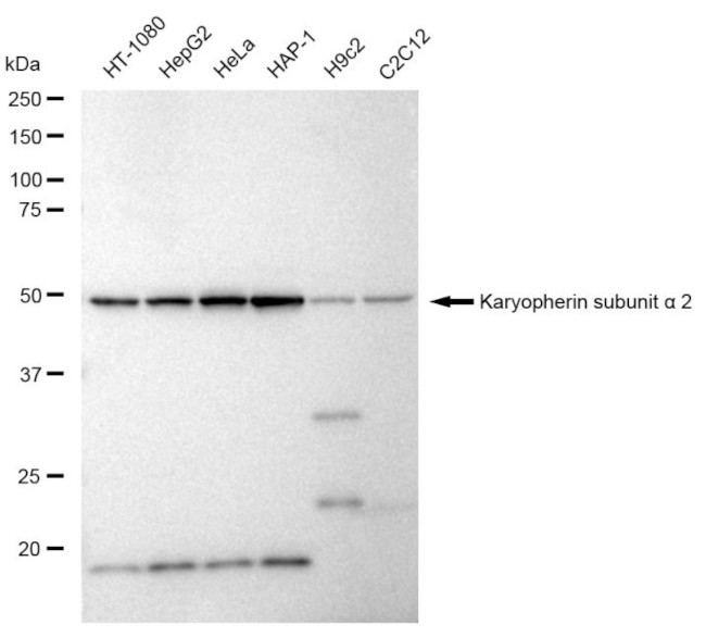 KPNA2 Antibody in Western Blot (WB)