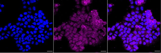GRK3 Antibody in Immunocytochemistry (ICC/IF)