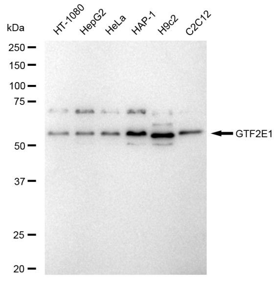 GTF2E1 Antibody in Western Blot (WB)