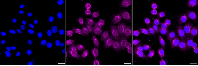 HOXC6 Antibody in Immunocytochemistry (ICC/IF)