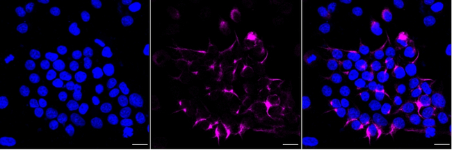 alpha Internexin Antibody in Immunocytochemistry (ICC/IF)