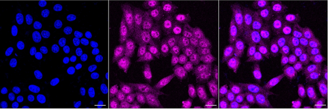 IRAK2 Antibody in Immunocytochemistry (ICC/IF)