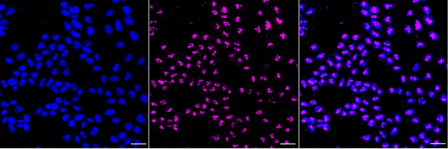 Laminin gamma-1 Antibody in Immunocytochemistry (ICC/IF)