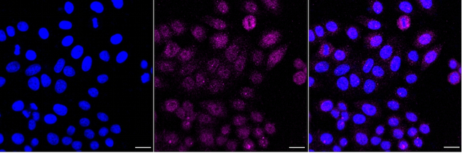 GRB7 Antibody in Immunocytochemistry (ICC/IF)