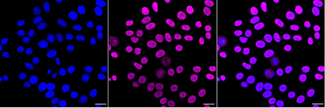GTPBP4 Antibody in Immunocytochemistry (ICC/IF)