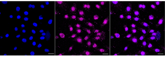 GTF2F2 Antibody in Immunocytochemistry (ICC/IF)