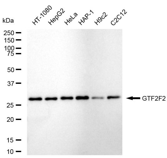 GTF2F2 Antibody in Western Blot (WB)